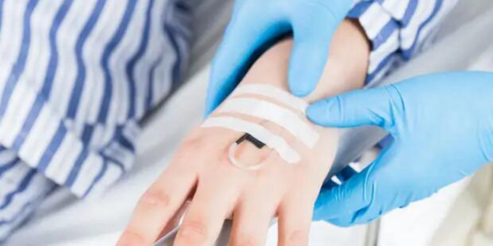 Enhancing Vascular Procedures with Antmed’s Inflation Device for Angioplasty